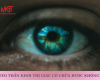 TEO THẦN KINH THỊ GIÁC CÓ CHỮA ĐƯỢC KHÔNG?